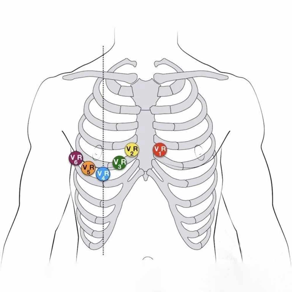 the 13rd ECG lead location range